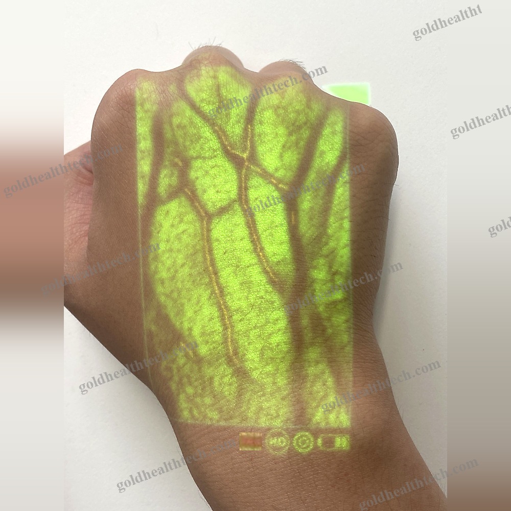 Led Vein Viewer