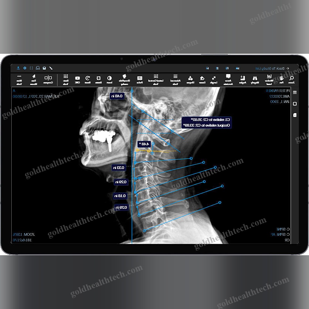 Medical Imaging Pacs