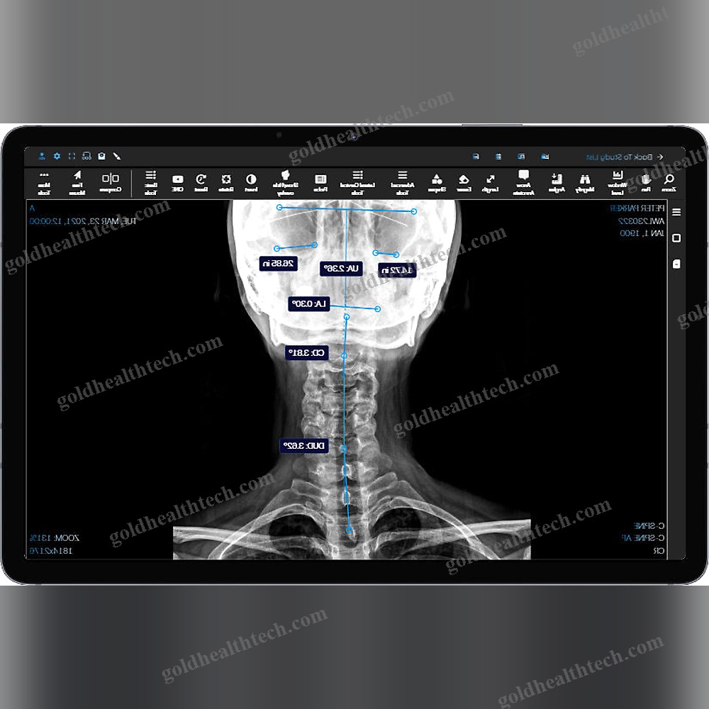 Medical Imaging Pacs