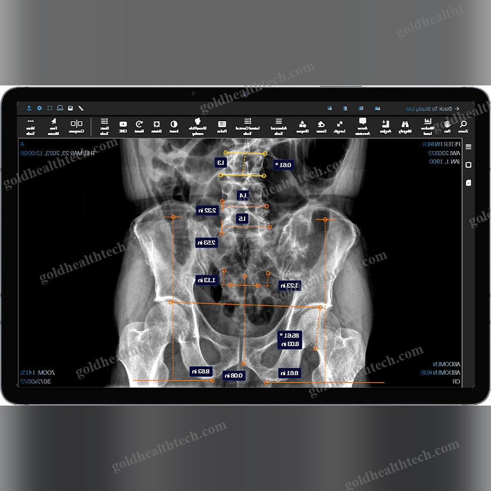 Medical Imaging Pacs
