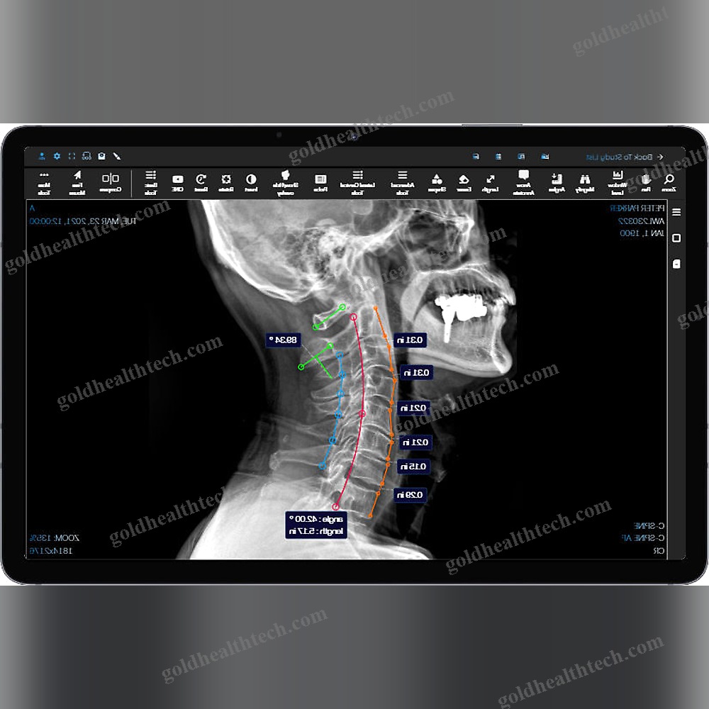Medical Imaging Pacs