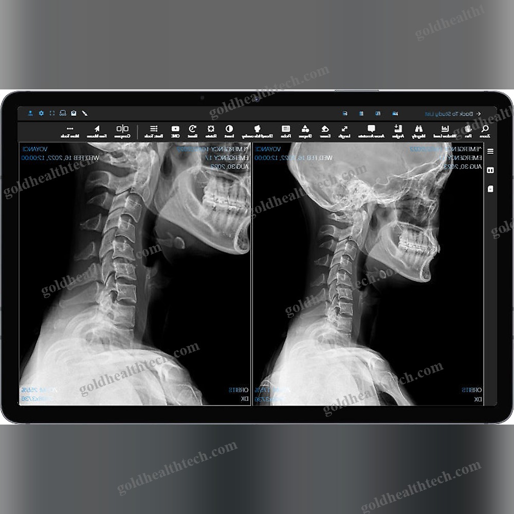 Medical Imaging Pacs