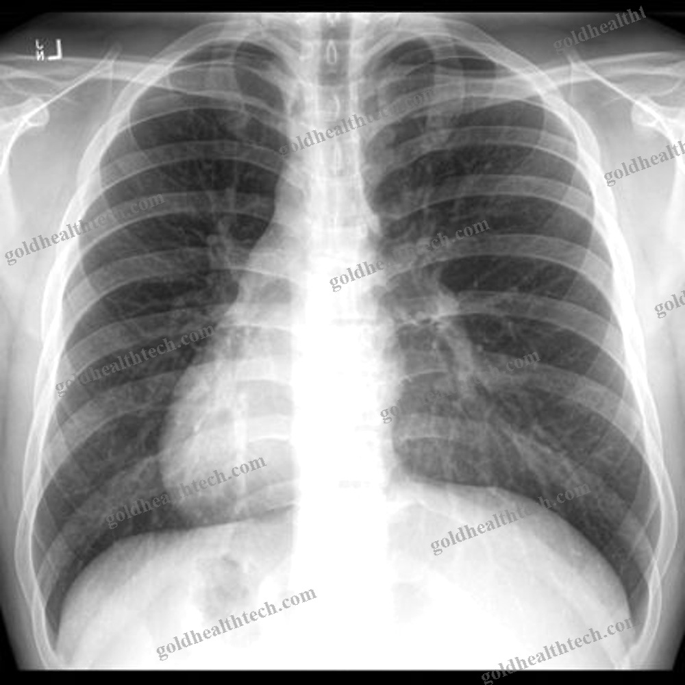 Medical Imaging Ai Platform