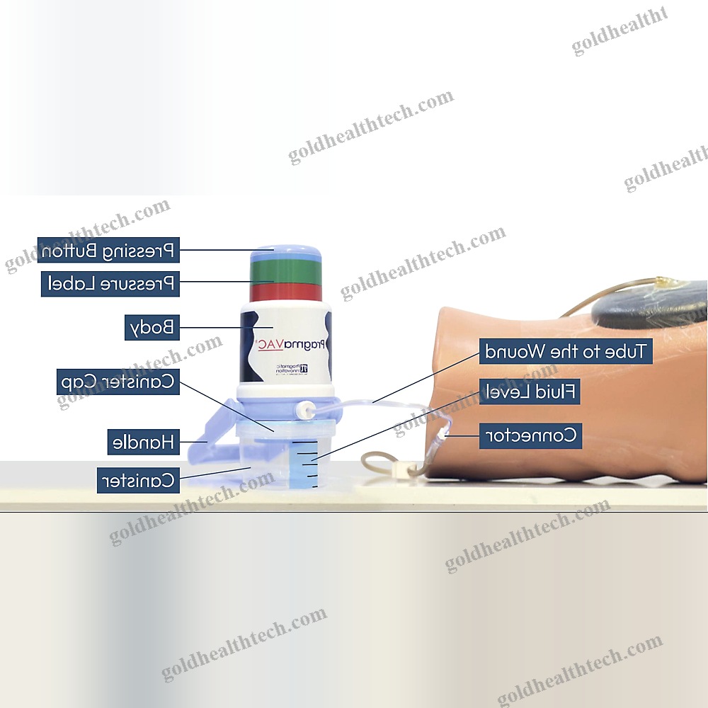 Manual Negative Pressure Wound Therapy Unit