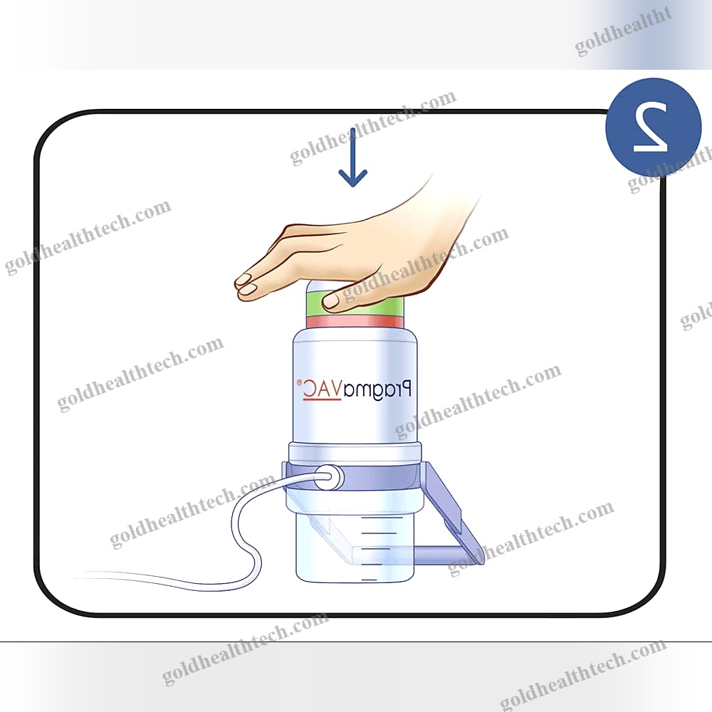 Manual Negative Pressure Wound Therapy Unit