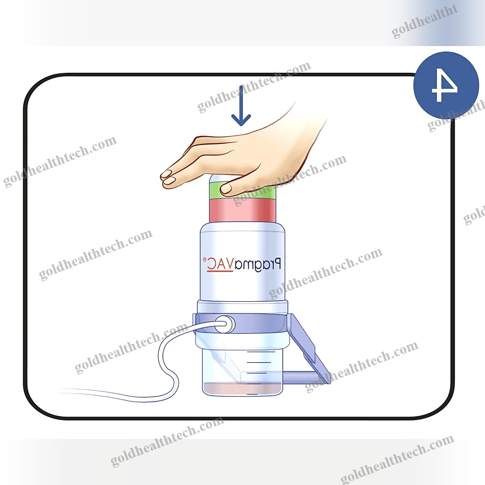 Manual Negative Pressure Wound Therapy Unit