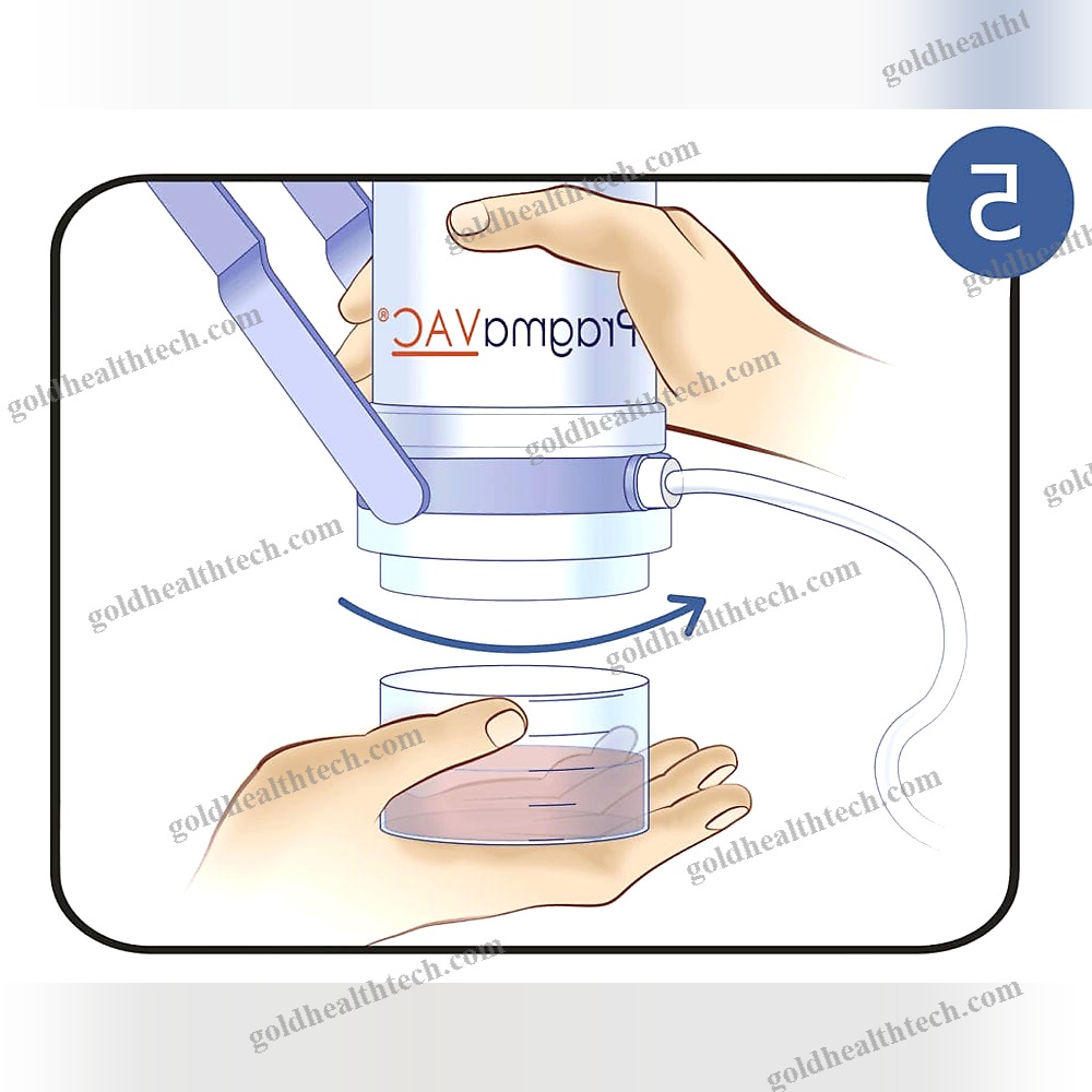 Manual Negative Pressure Wound Therapy Unit