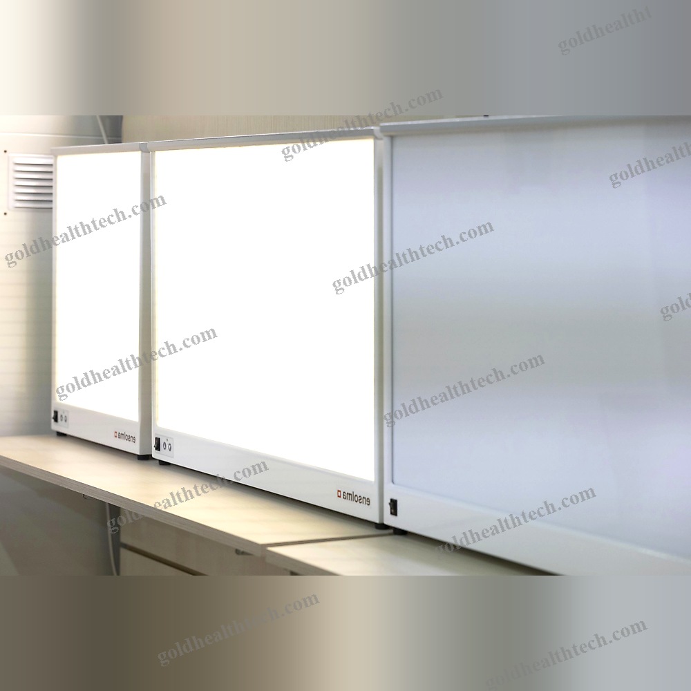 1-Screen X-Ray Film Viewer