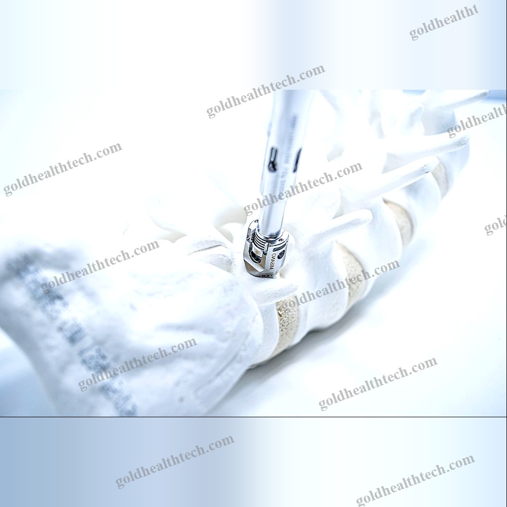 Thoraco-Lumbo-Sacral Osteosynthesis Unit