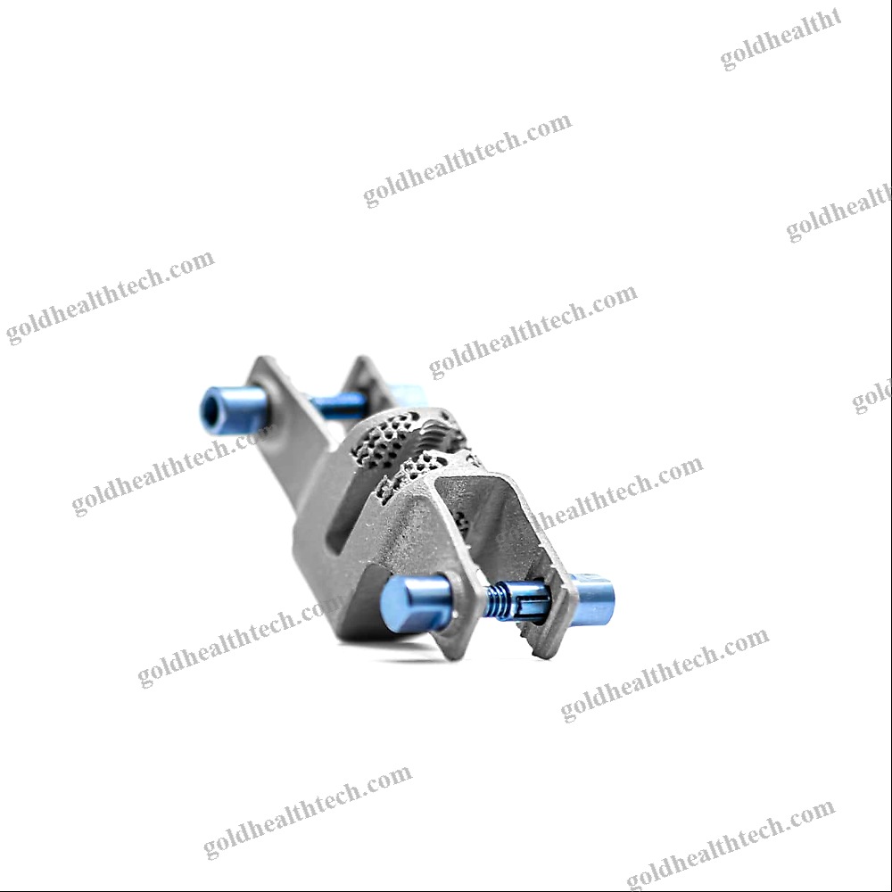 Lumbar Interspinous Vertebral Implant