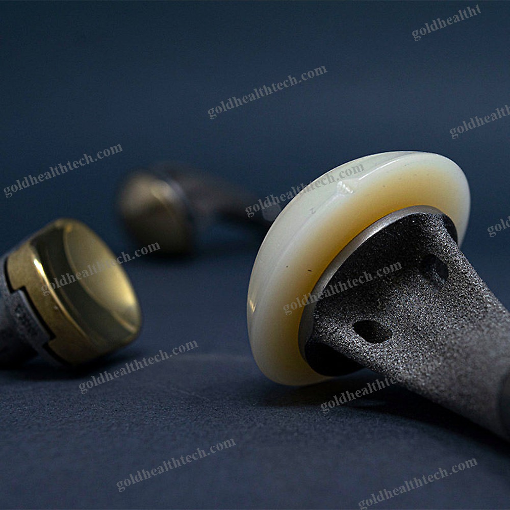 Modular Shoulder Prosthesis