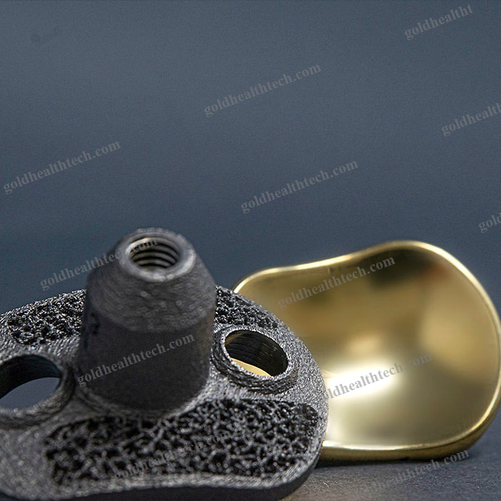 Modular Shoulder Prosthesis