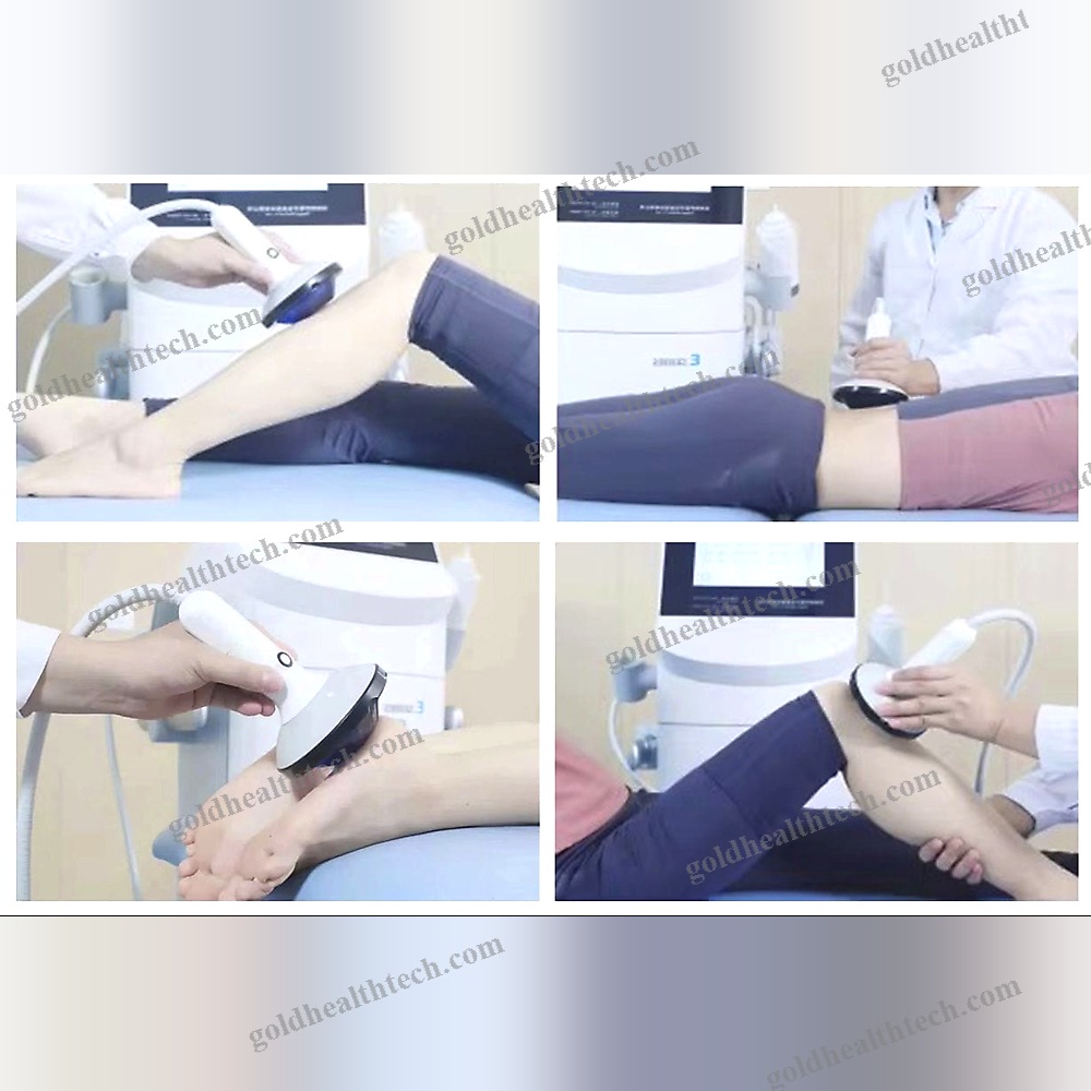 Orthopedic Treatment Eswt Unit