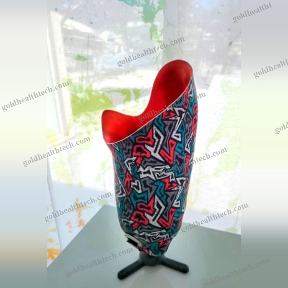 Transtibial Prosthetic Socket