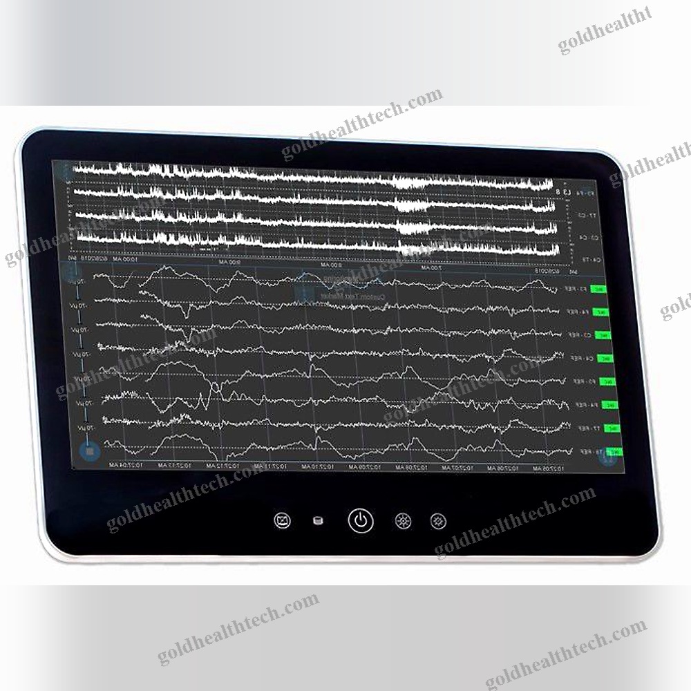 Handheld Patient Monitor