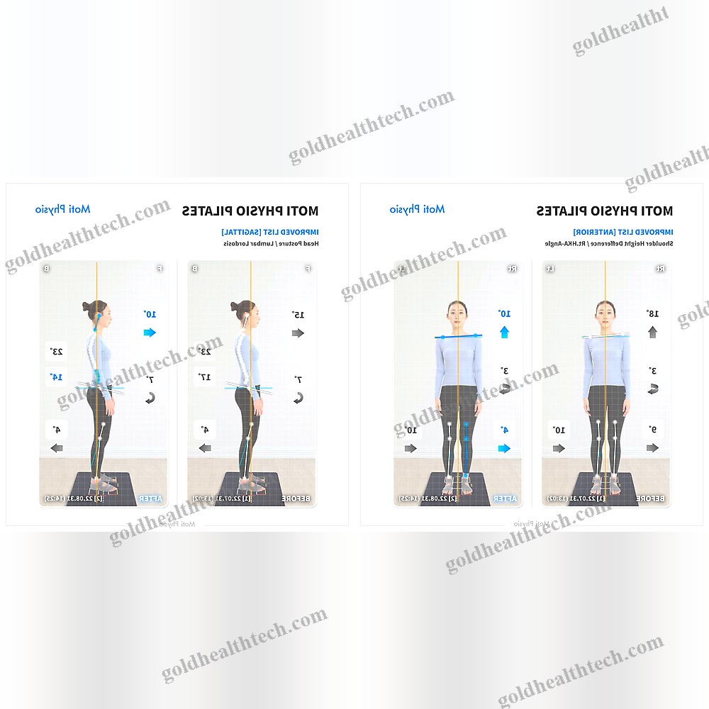 Balance Evaluation System