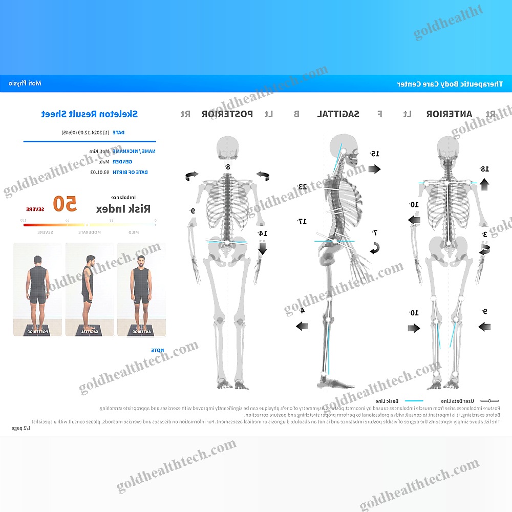 Balance Evaluation System