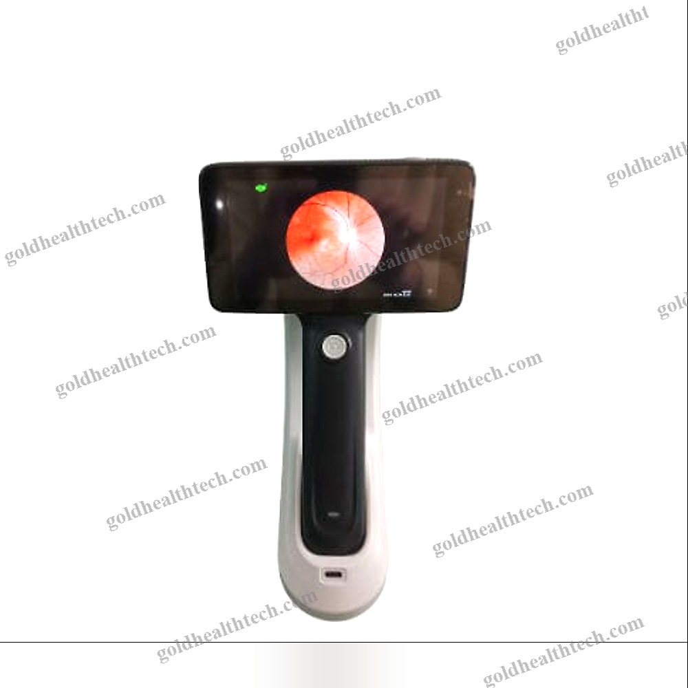 Non-Mydriatic Retinal Camera