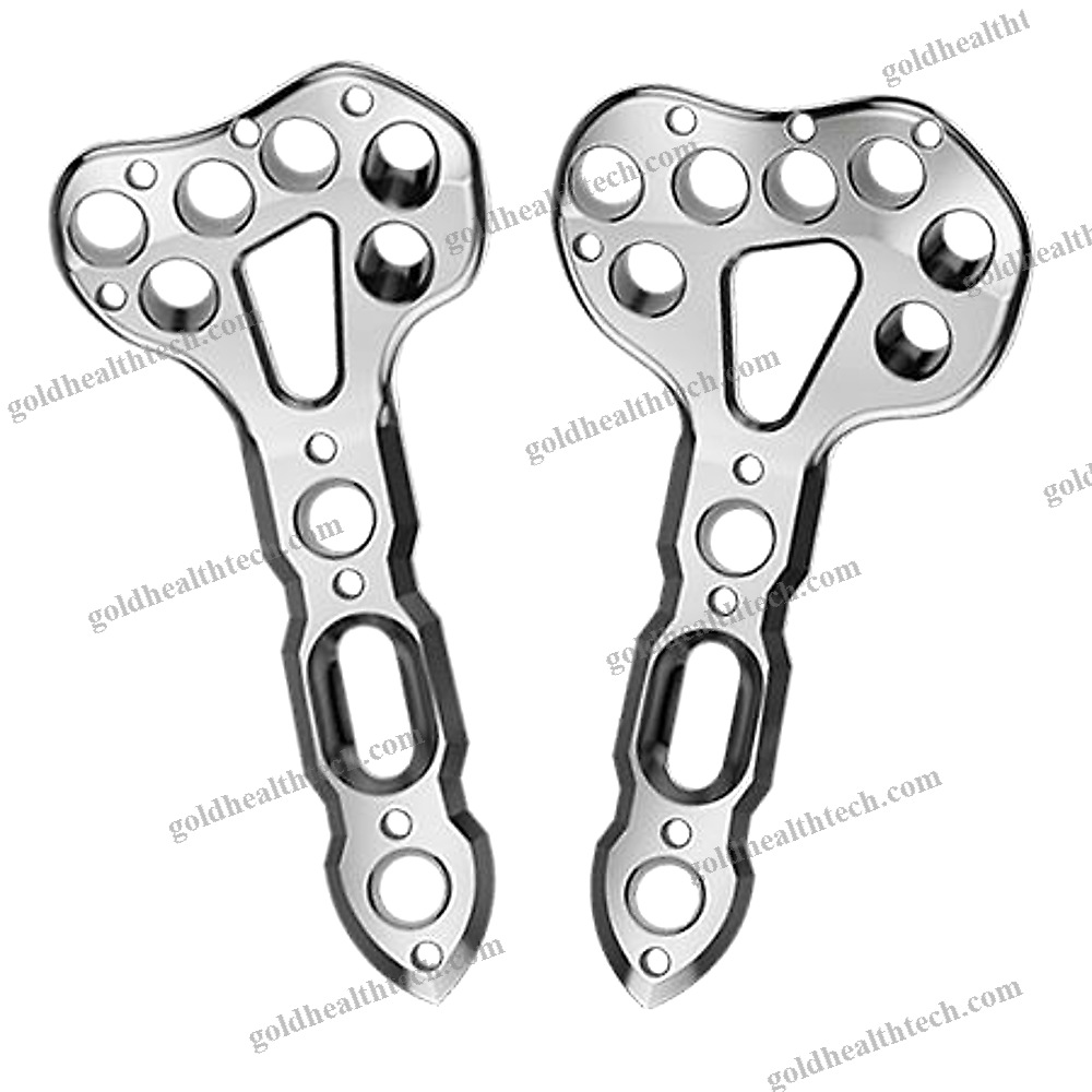 Radius Compression Plate