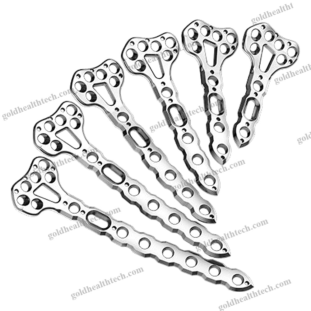 Radius Compression Plate