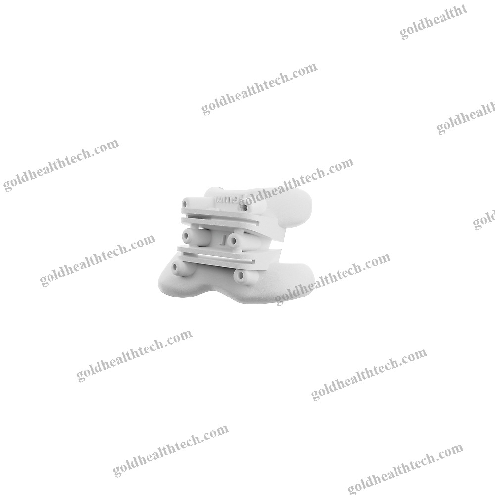 Tibial Osteotomy Resection Guide