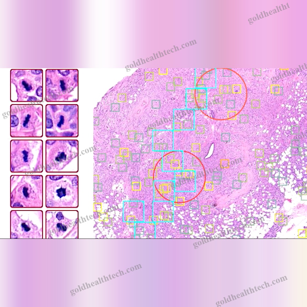 Breast Cancer Screening Ai Platform