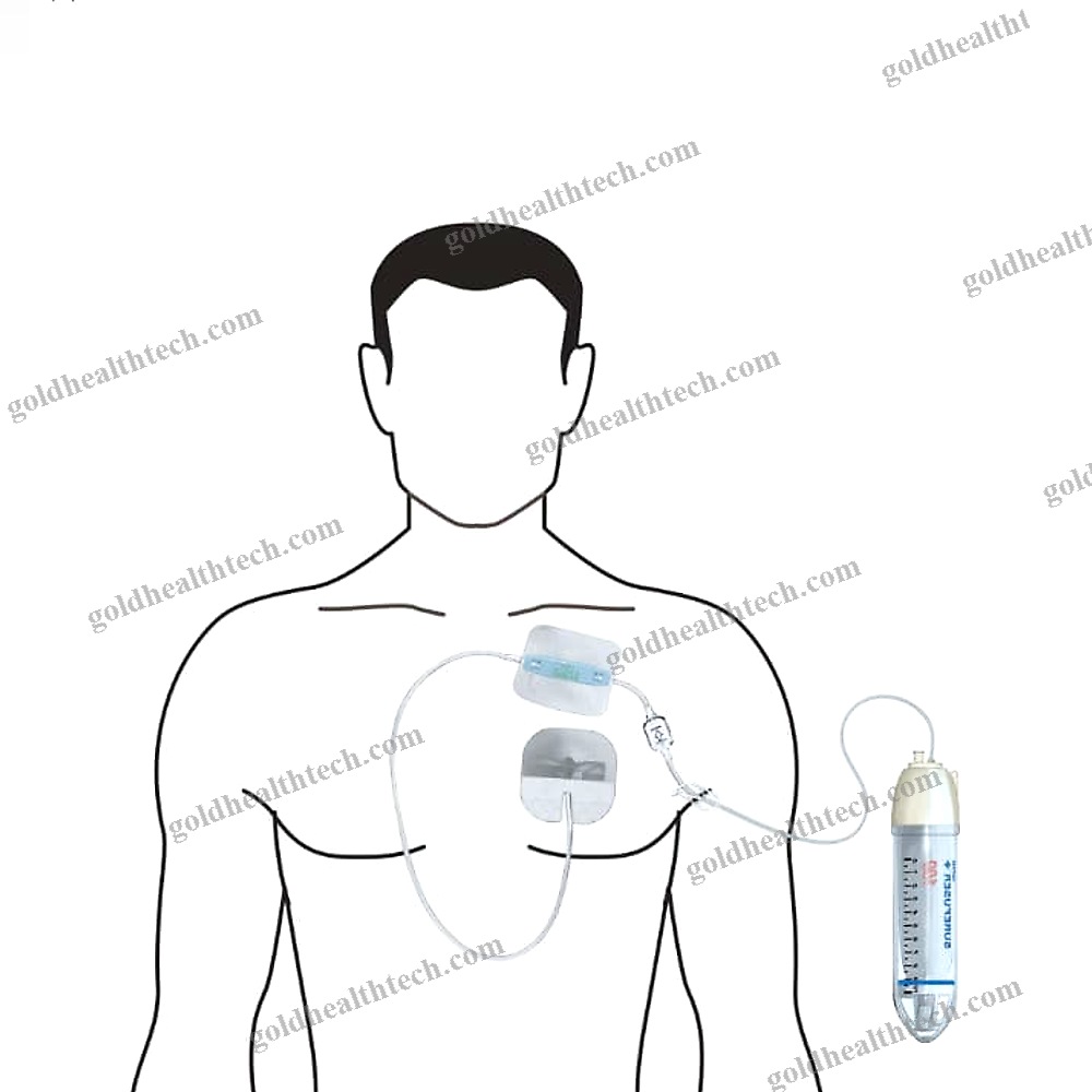 1-Channel Infusion Pump