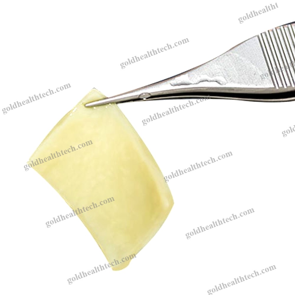 Buccal Tissue Matrix