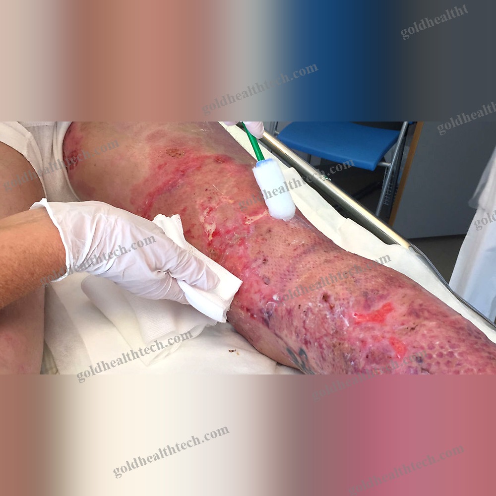 Absorbent Medical Mat