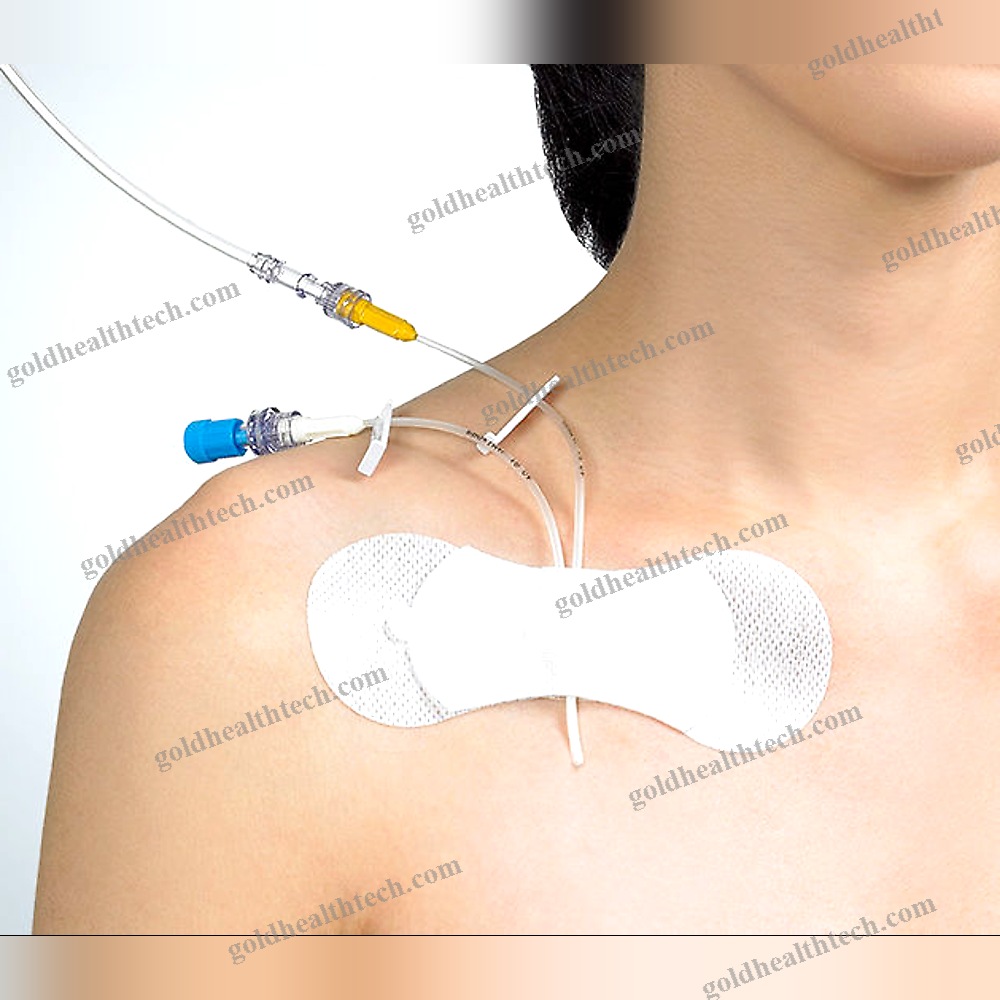 Iv Catheter Band