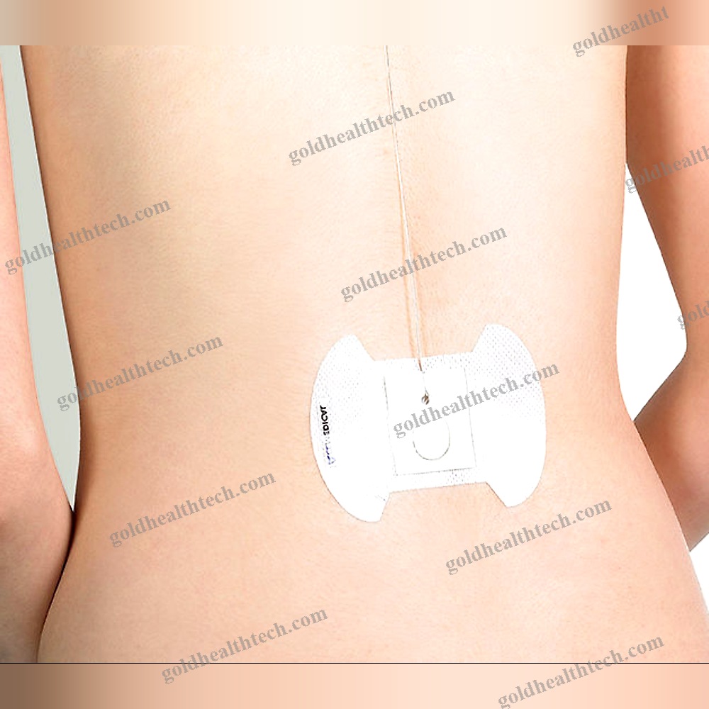 Iv Catheter Band