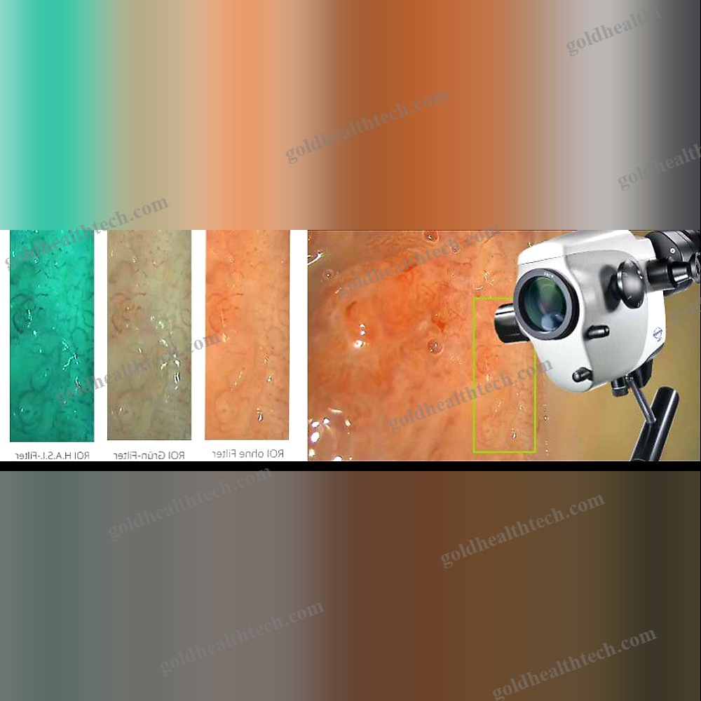 Binocular Colposcope