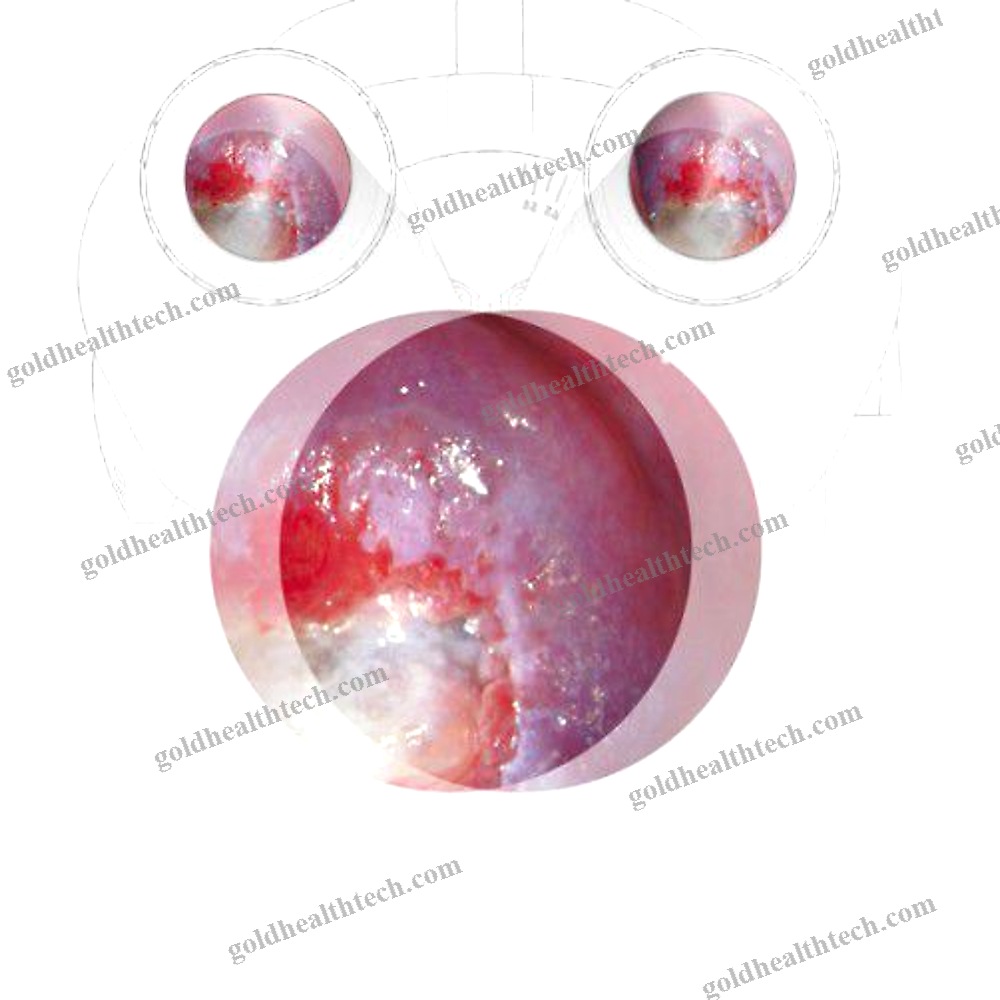 Binocular Colposcope
