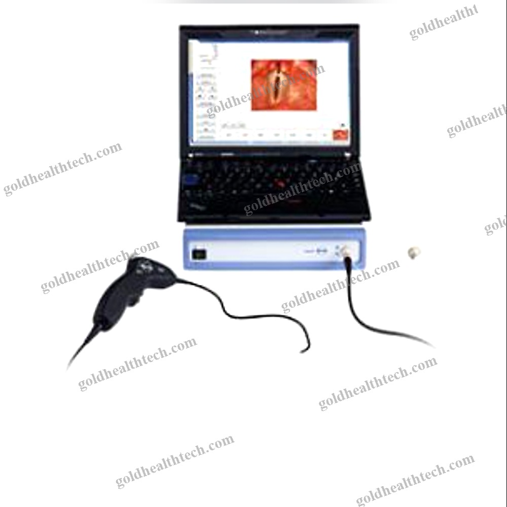 Wide-Angle Video Laryngoscope