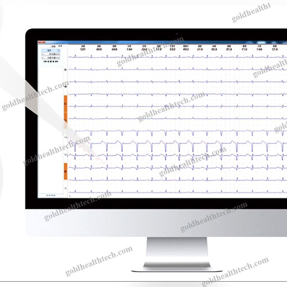 12-Channel Holter Monitor