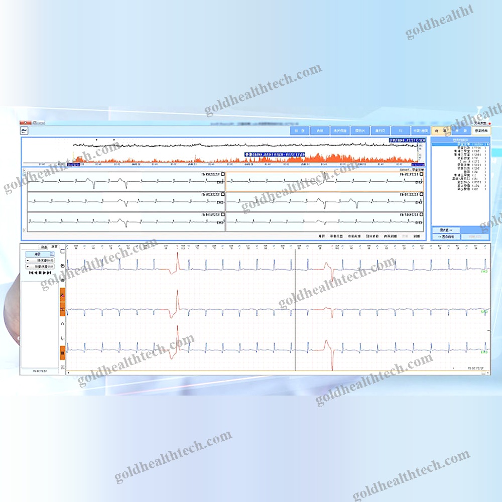 12-Channel Holter Monitor