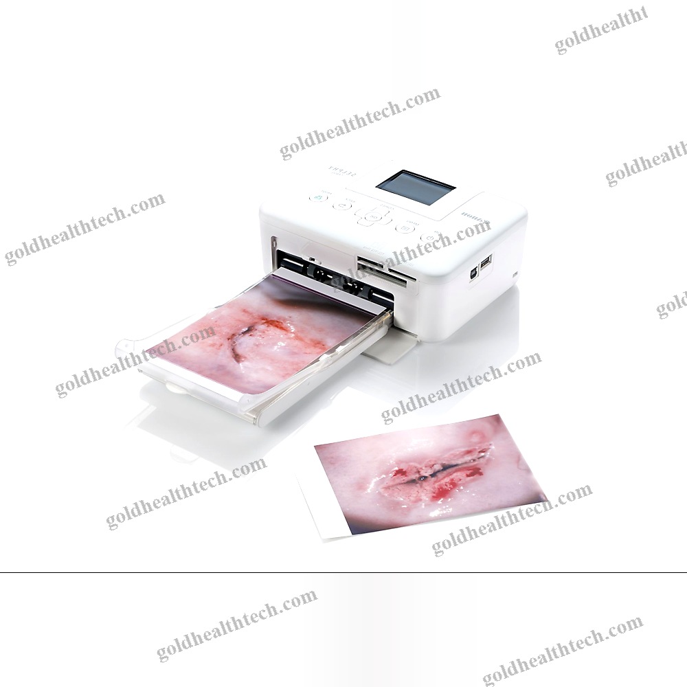 Binocular Colposcope