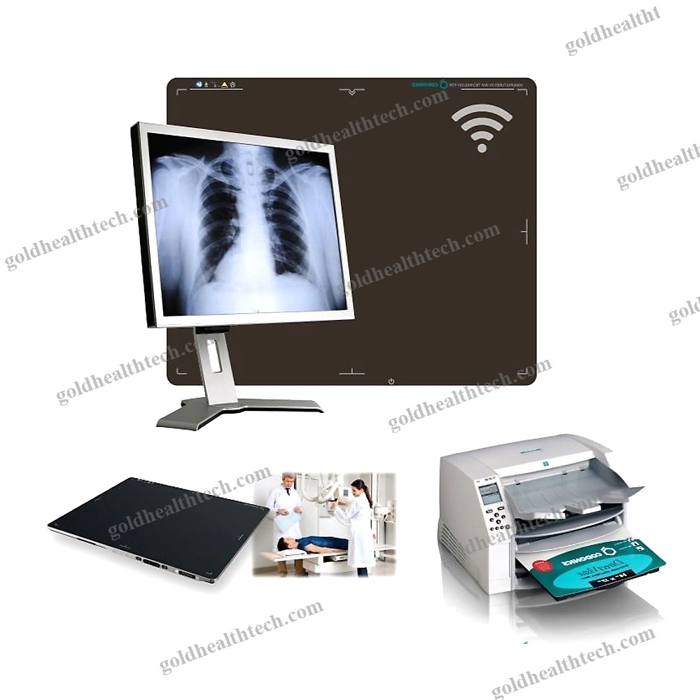 Radiography Acquisition System