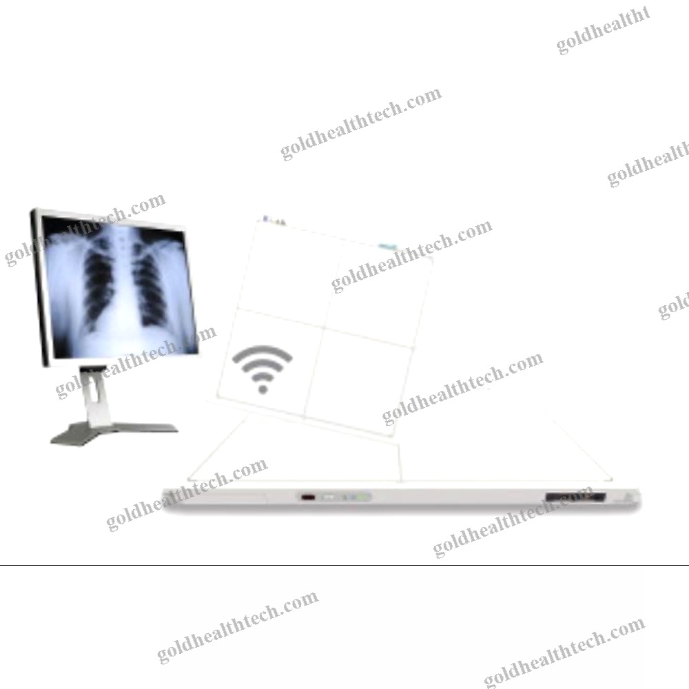 Radiography Acquisition System