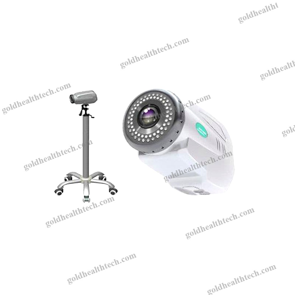 Video Colposcope