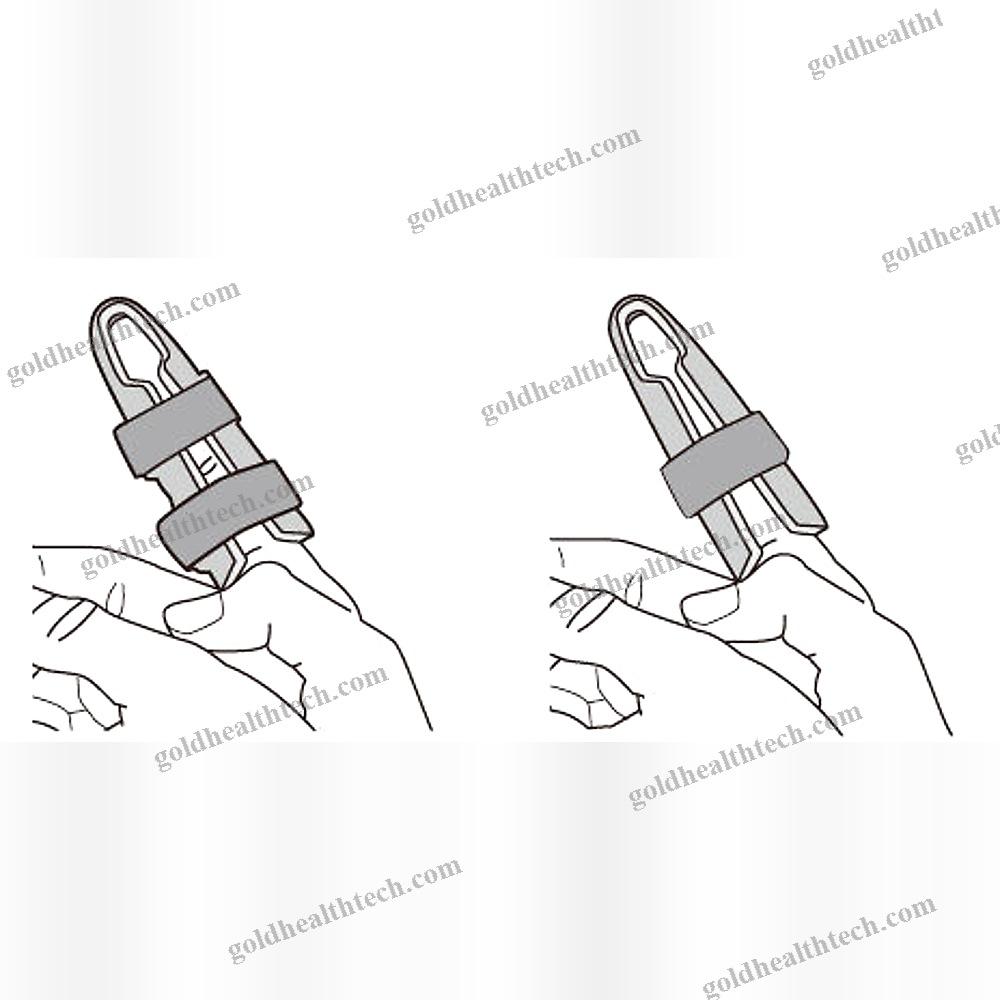 Cot Finger Splint