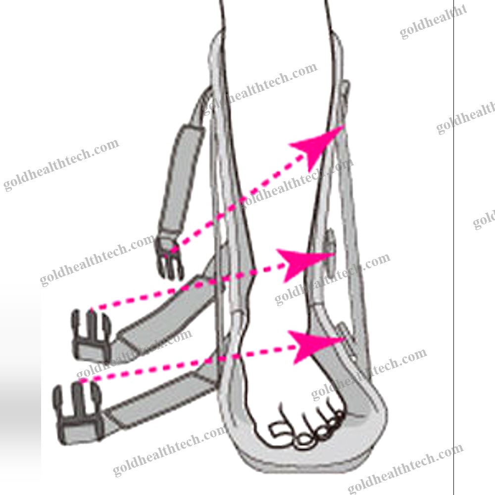 Adult Plantar Fasciitis Splint