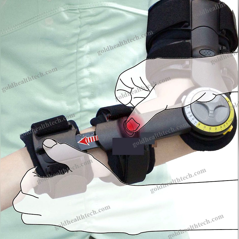 Elbow Splint