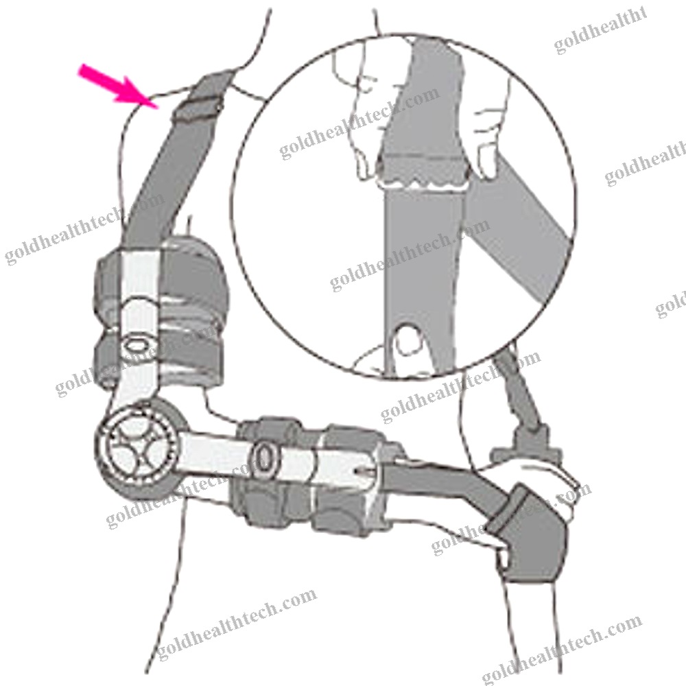 Elbow Splint