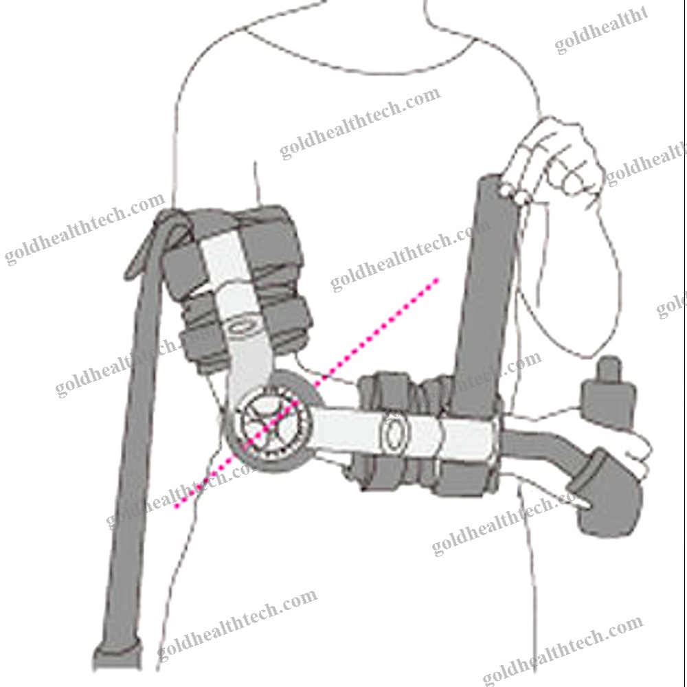 Elbow Splint