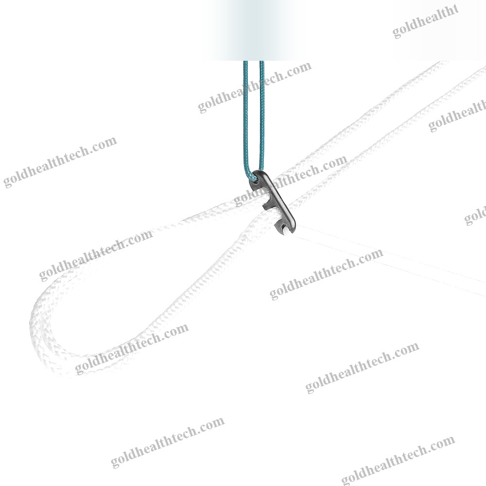 Acl Reconstruction Suture Button