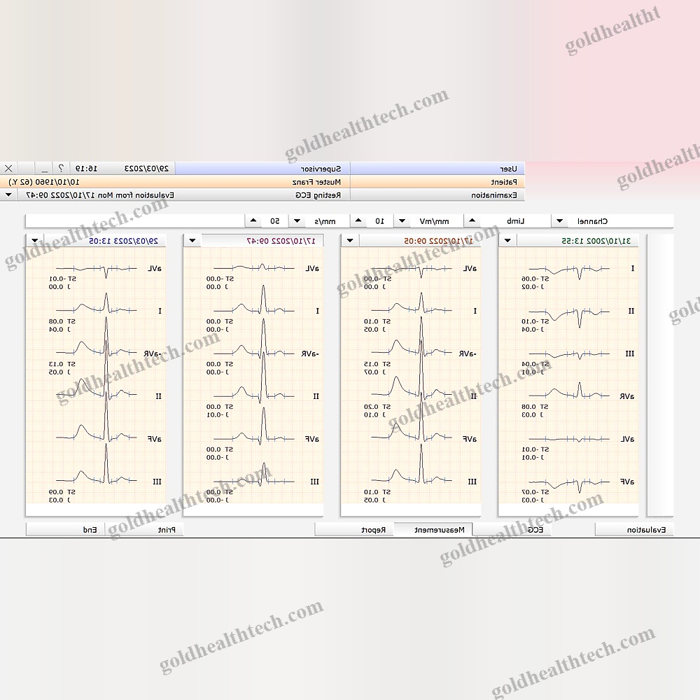 Electrocardiography Software Module