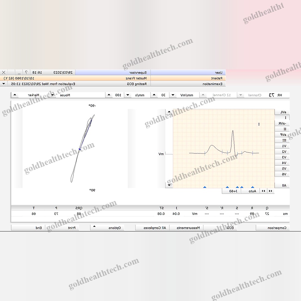 Electrocardiography Software Module