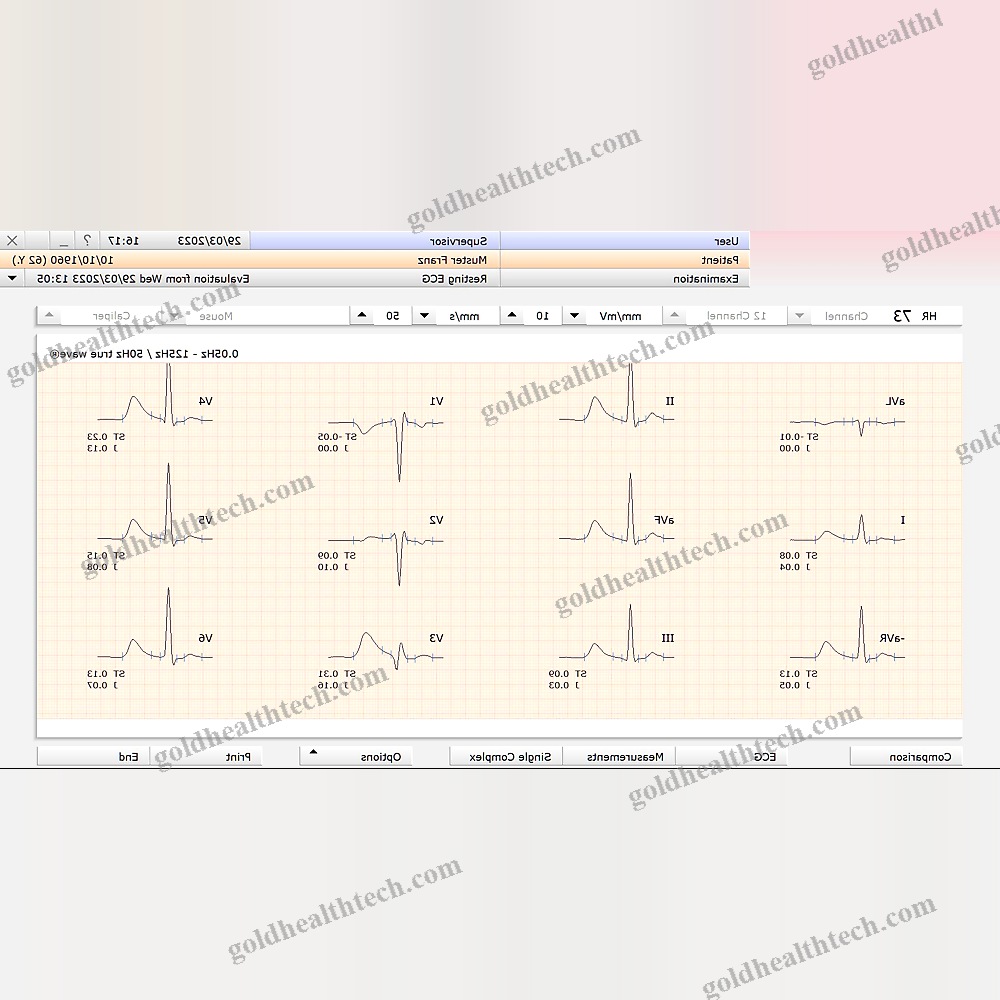 Electrocardiography Software Module