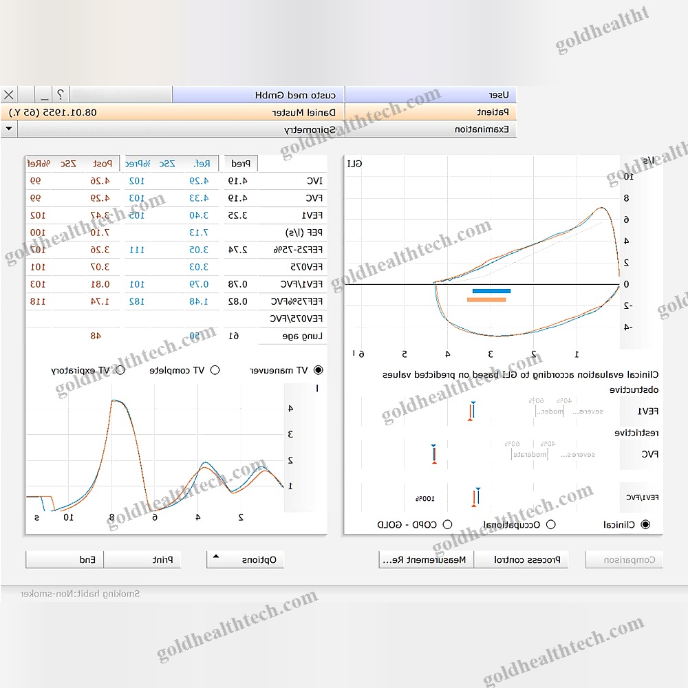 Spirometry Software Module